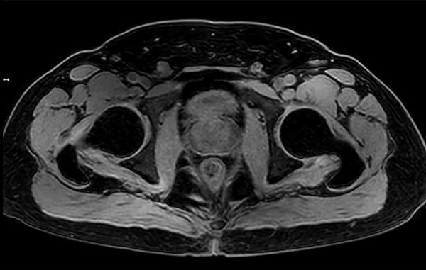 mDIXON XD - T1w FFE (Water only)