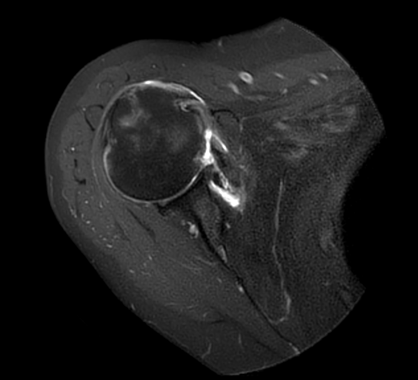 Axial MultiVane XD - PDw SPAIR
