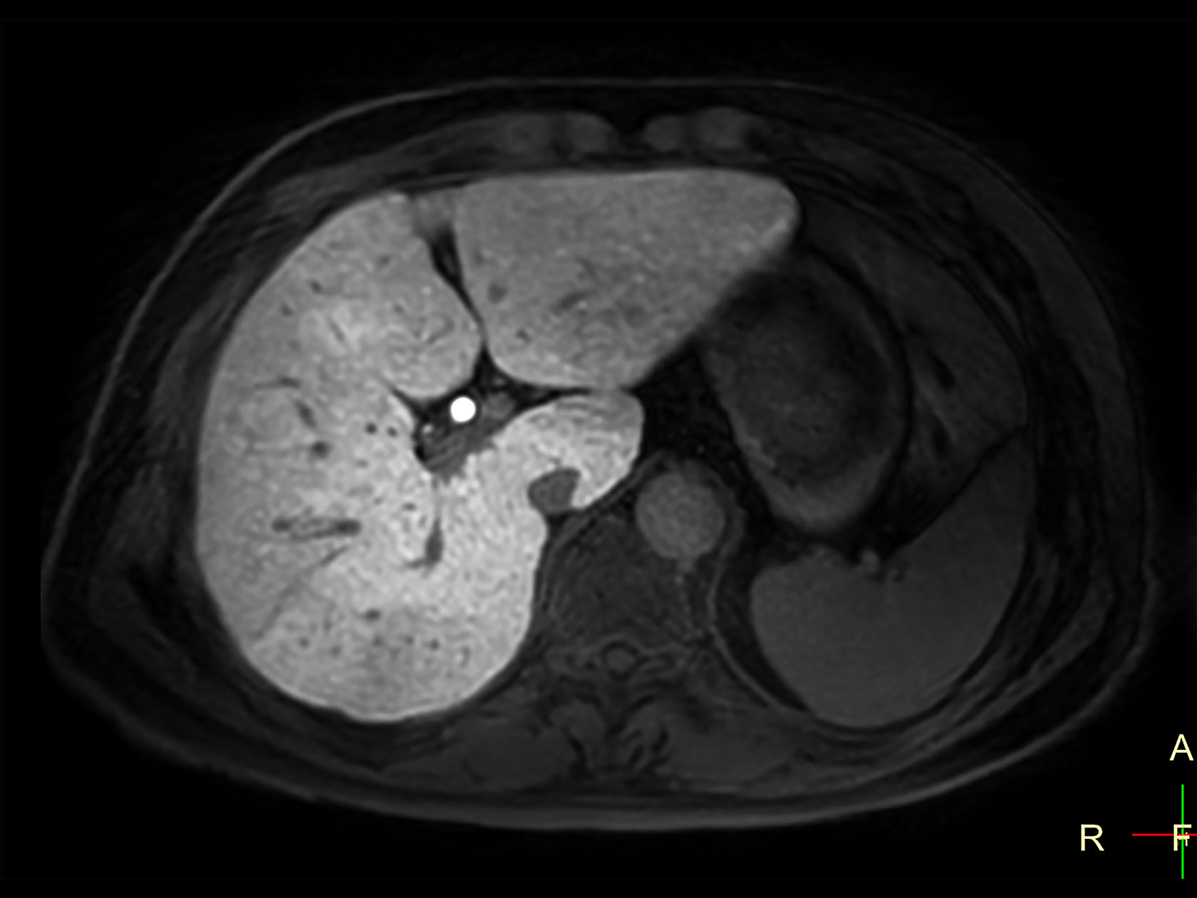 Axial 3D VANE XD (Water only)