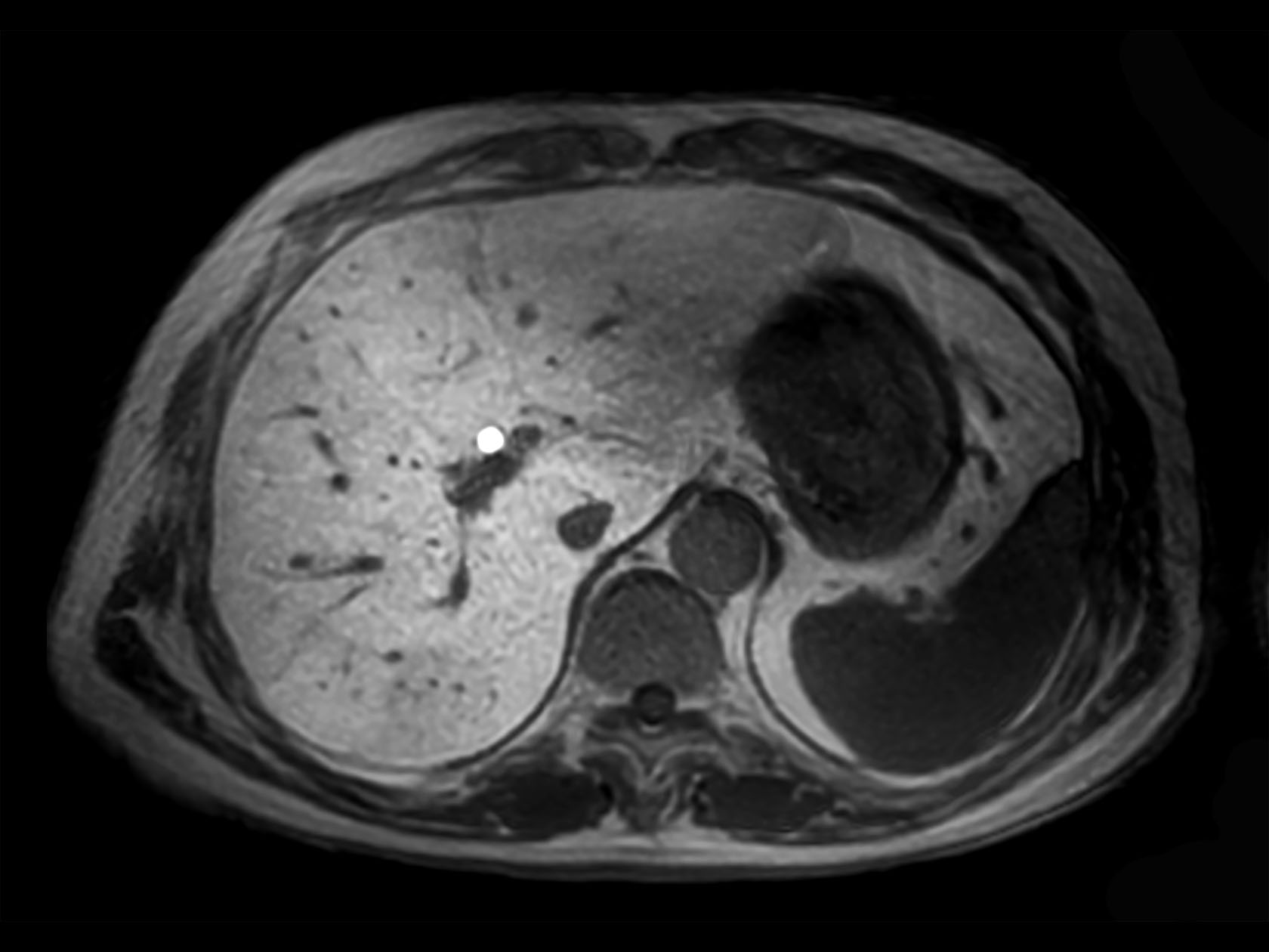 Axial 3D VANE XD (In Phase)