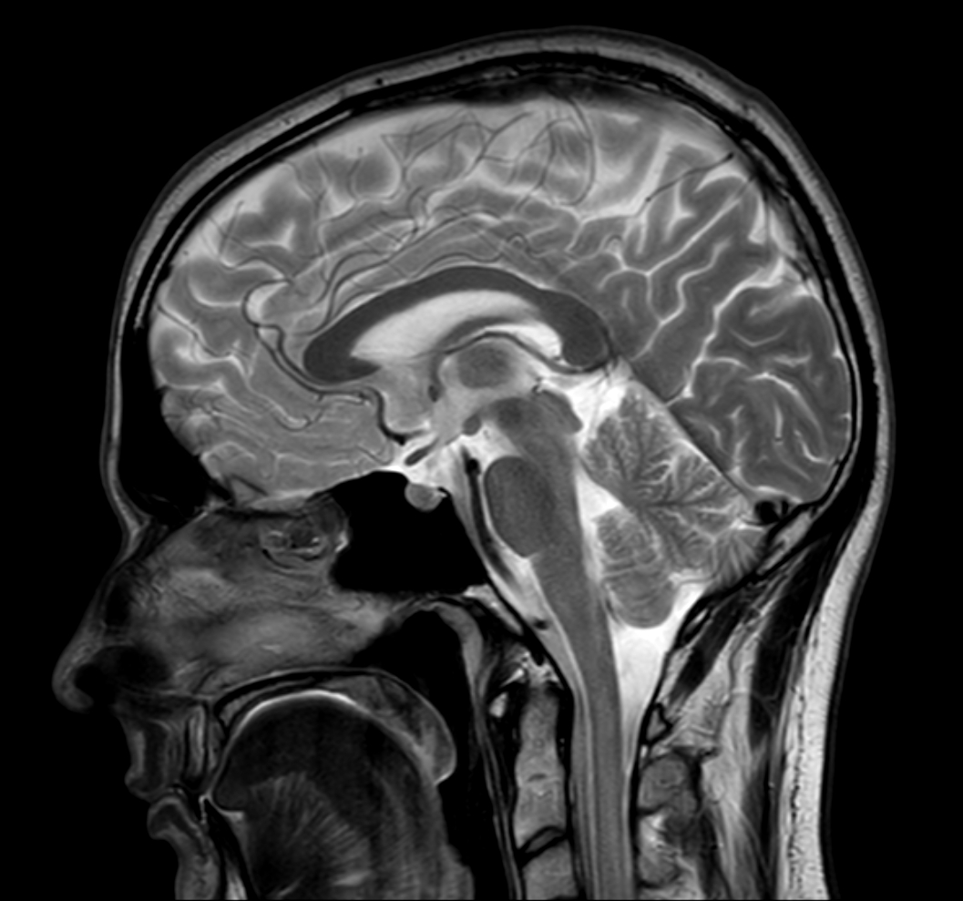 Sagittal T2w TSE with ComforTone
