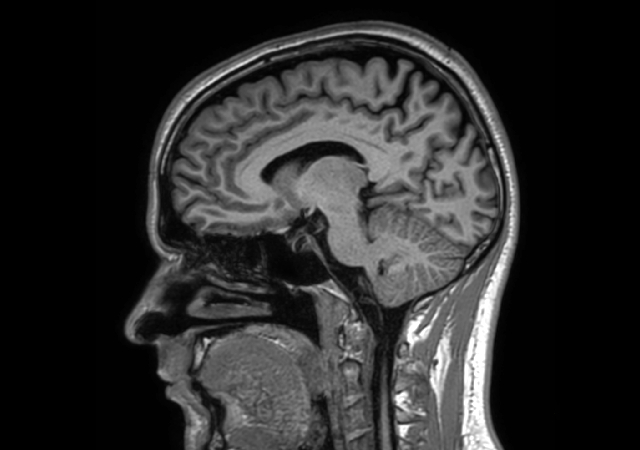 Sagittal 3D T1w TFE with ComforTone