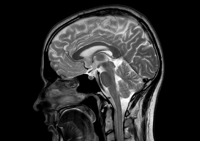 Sagittal T2w TSE with ComforTone