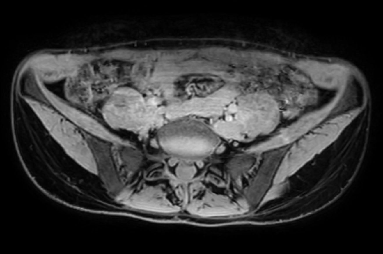 mDIXON XD - Water only