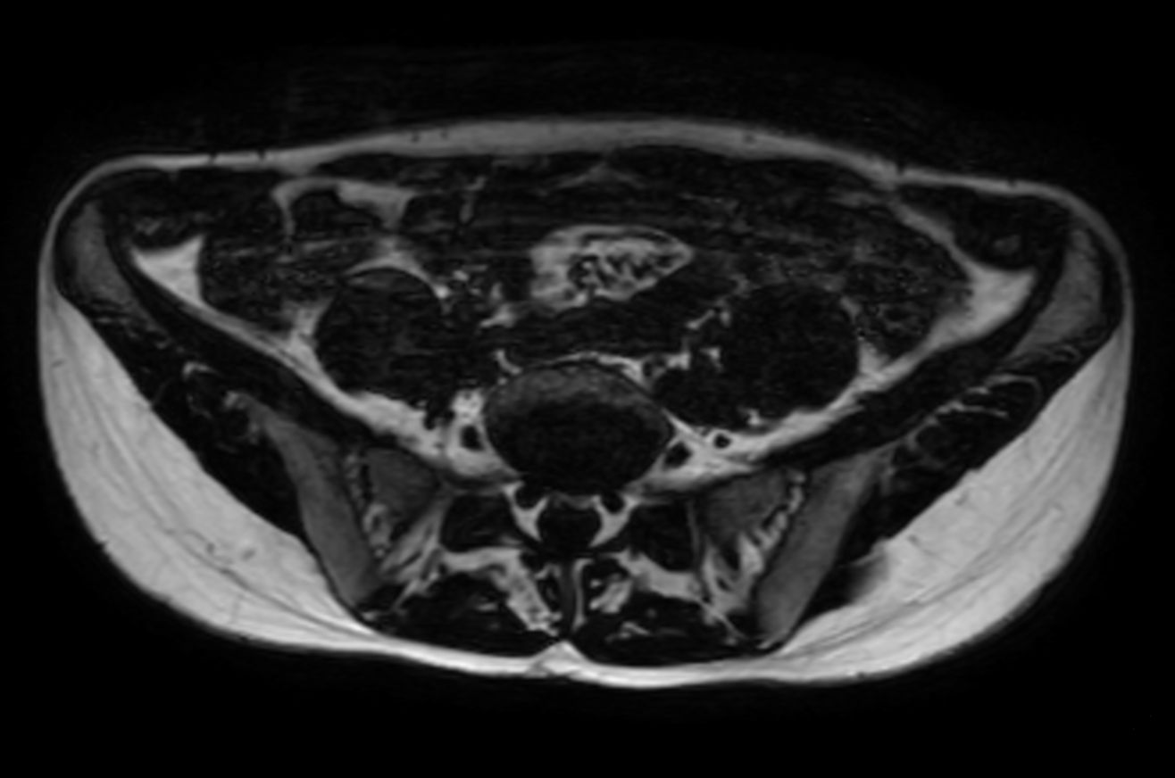 mDIXON XD - In Phase