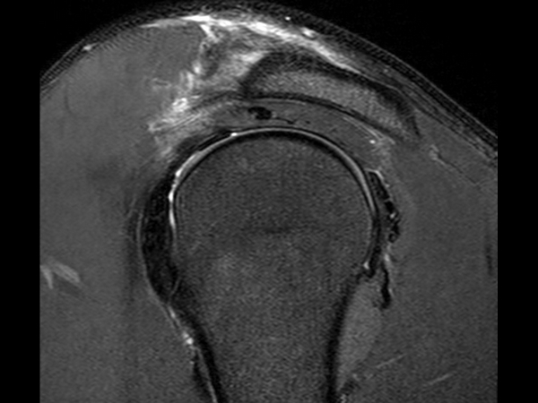 Sagittal T2w SPAIR