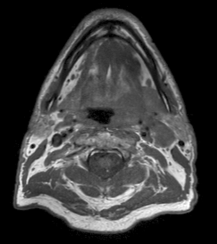 T1w TSE mDIXON (in-phase) pre contrast 