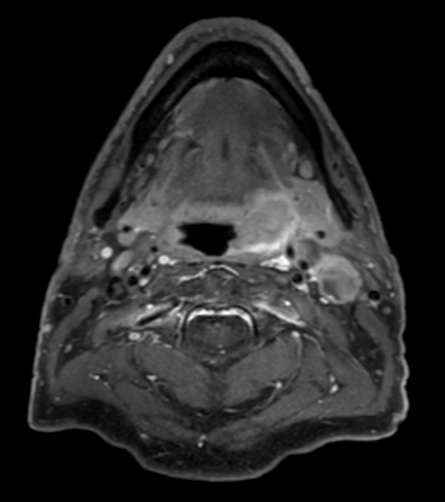 T1w TSE mDIXON (water only) post contrast
