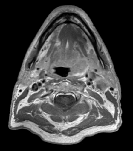 T1w TSE mDIXON (in-phase) post contrast