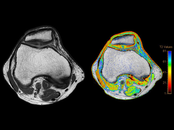 Axial multi-echo SE T2 calculation sequence