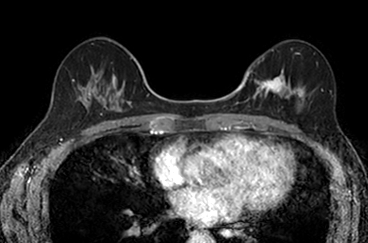 Axial dyn eTHRIVE plus gado