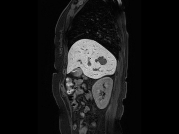 Sagittal eTHRIVE 