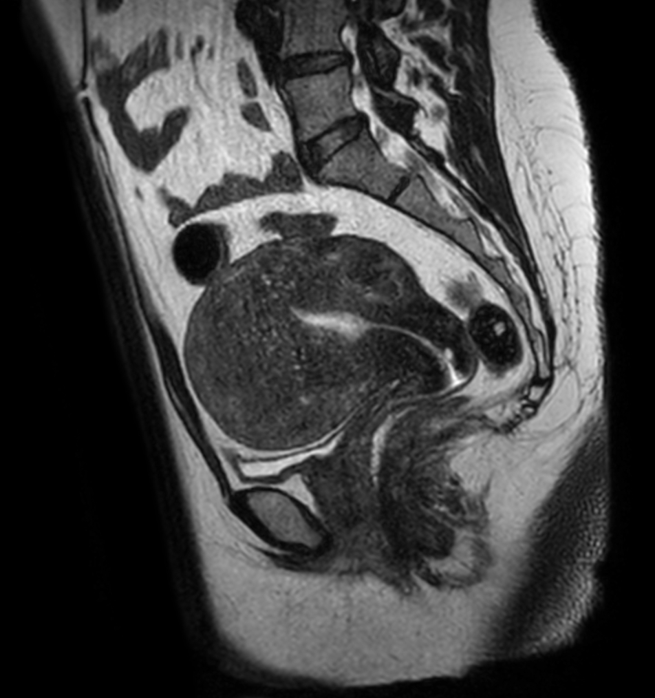 Sagittal 3D PelvisVIEW