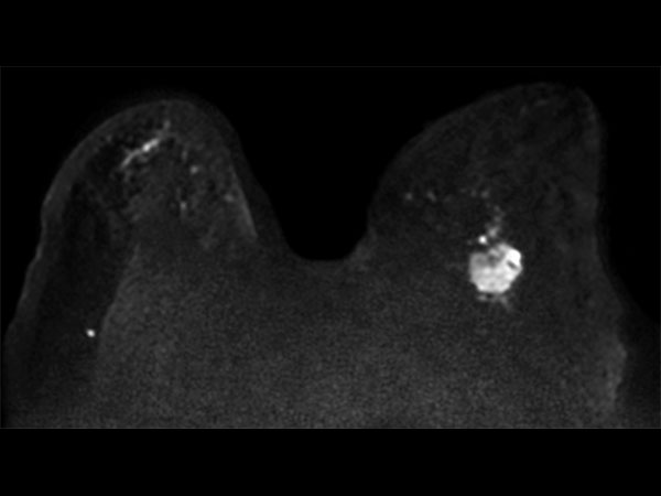 Axial Diffusion (b800)