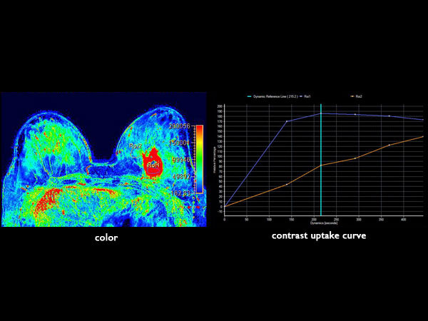 Dynamic axial eTHRIVE