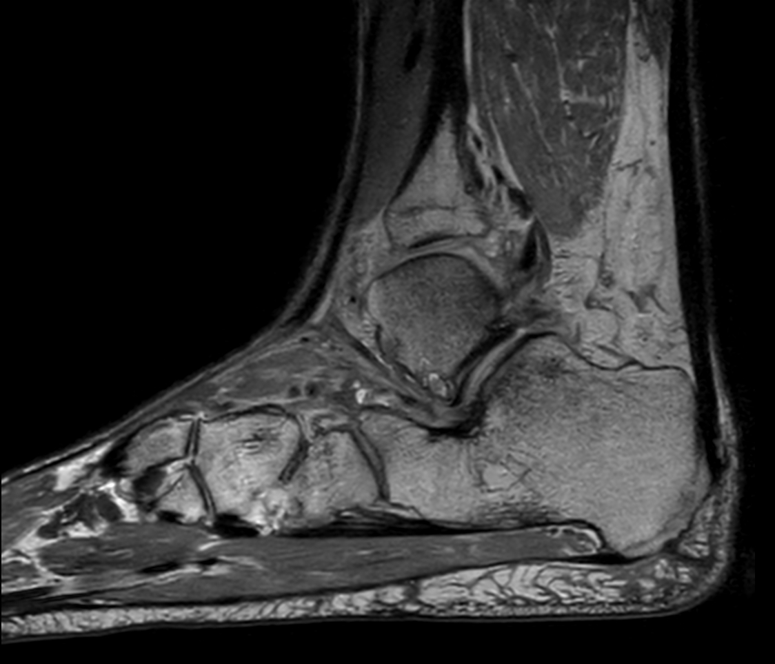 Sagittal 3D PDw MSK VIEW