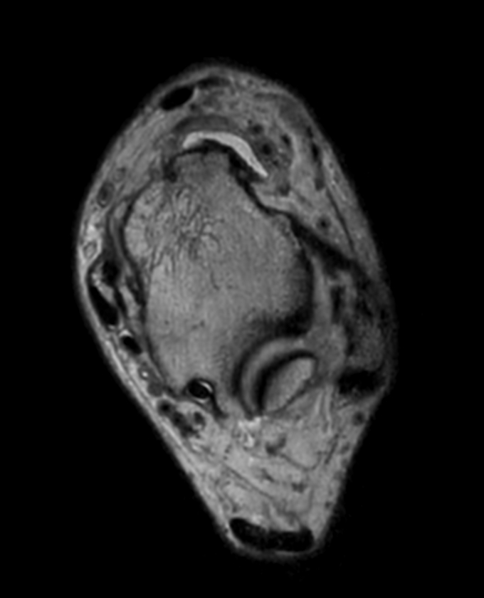 Axial 3D PDw MSK VIEW