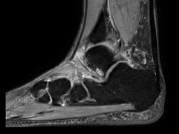 Sagittal PDw TSE mDIXON XD (Water only)