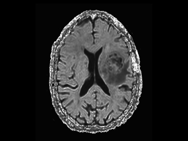 Axial DWI (eADC)