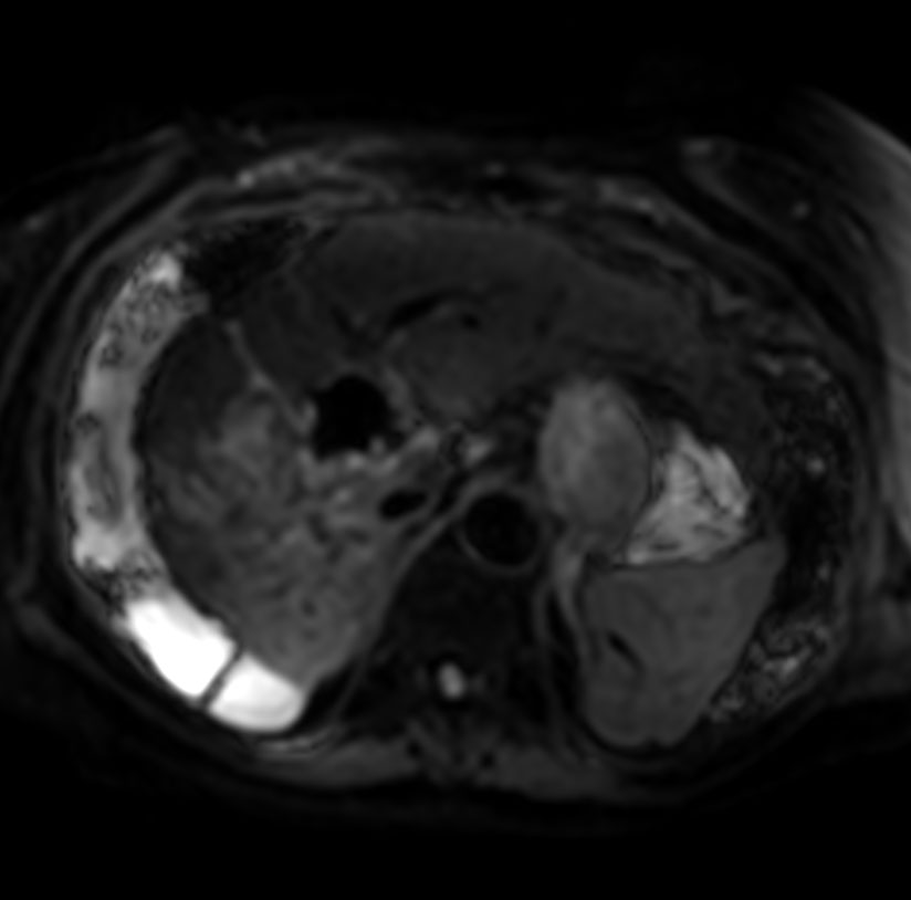 Axial Diffusion - b50