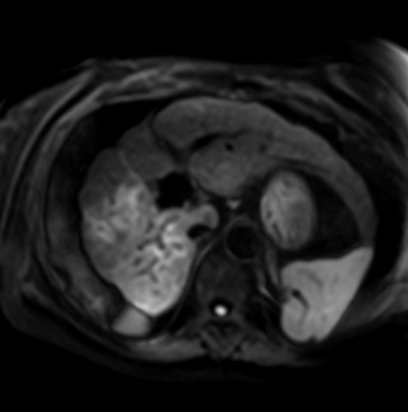 Axial Diffusion - b600