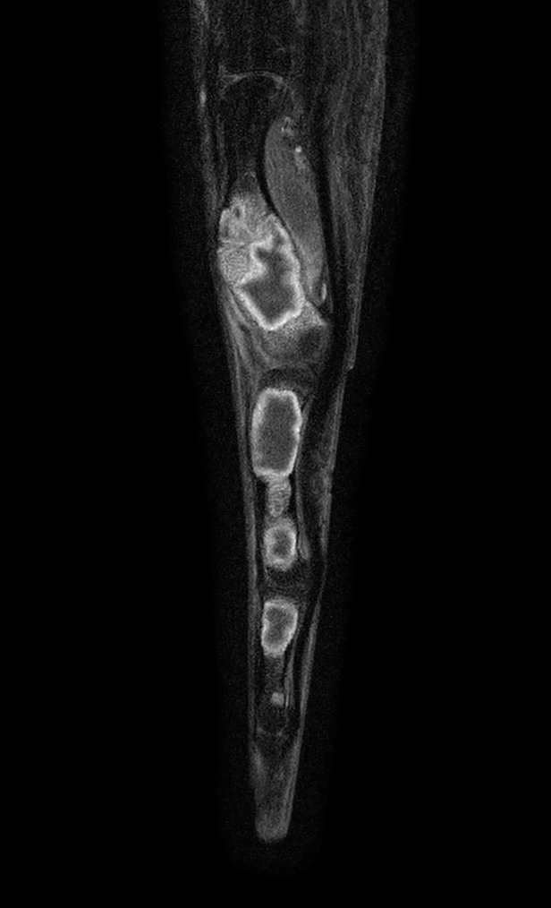 Sagittal T1w mDIXON XD TSE (Water only) (with gado)