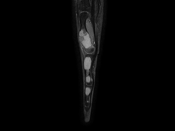 Sagittal T1w mDIXON XD TSE (Water only)