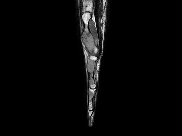 Sagittal T1w mDIXON XD TSE (In Phase)