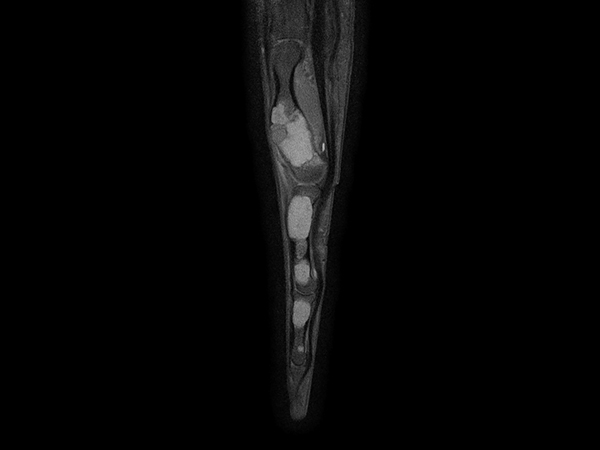 Sagittal T1w mDIXON XD TSE (Partial FatSat)