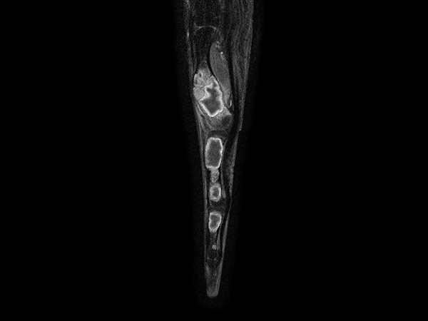 Sagittal T1w mDIXON XD TSE (Water only) (with gado)