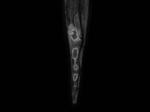 Sagittal T1w mDIXON XD TSE (Partial FatSat) (with gado)