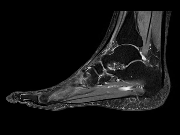 Sagittal PDw mDIXON XD TSE (Water only)