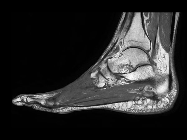 Sagittal T1w TSE