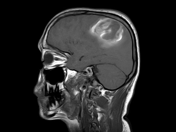 Sagittal T1w SE