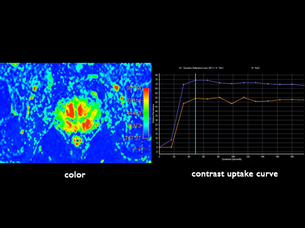 Dynamic axial eTHRIVE