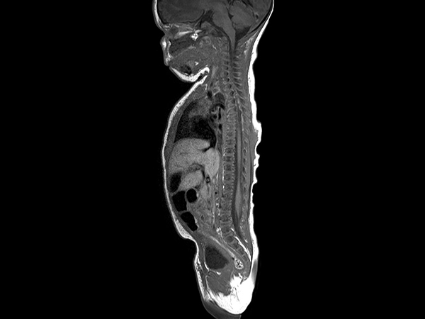 Sagittal T1w TSE