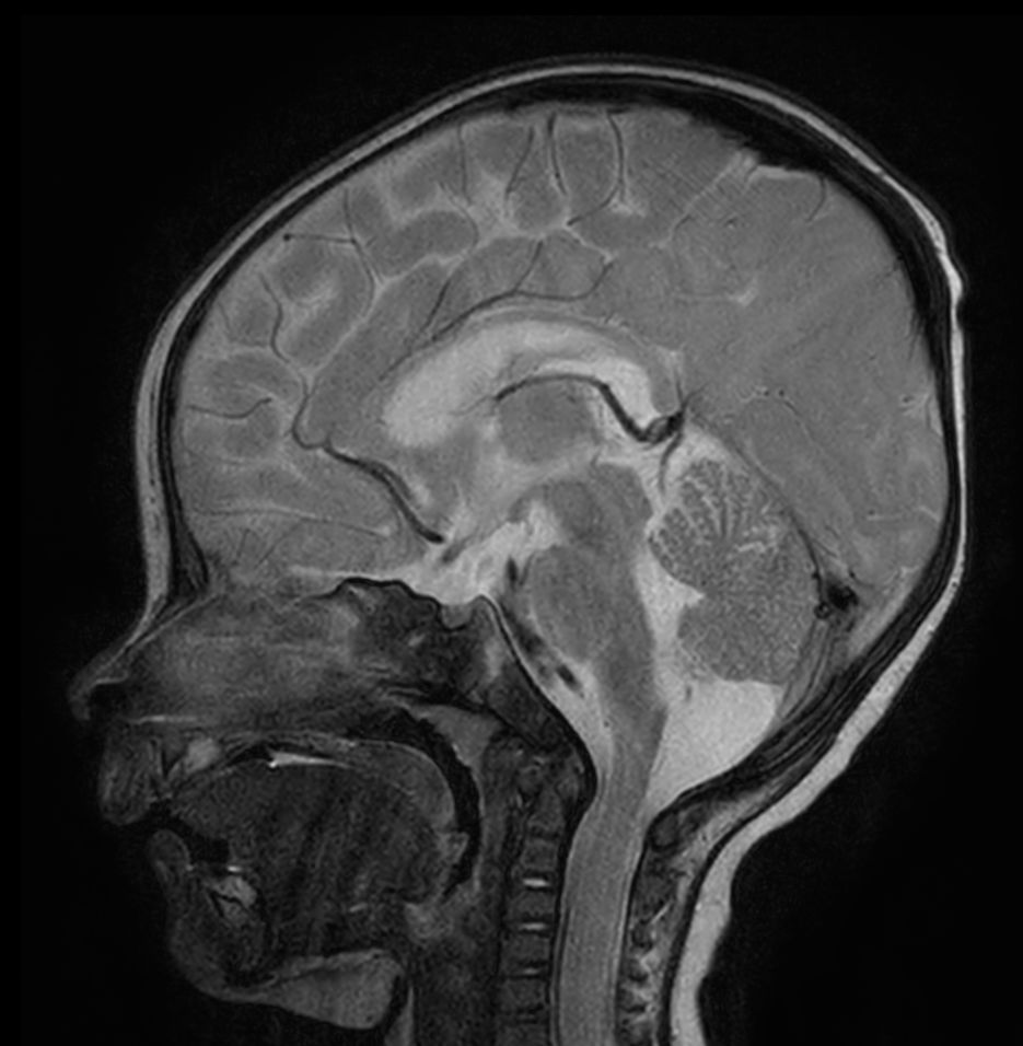 Sagittal T2w TSE with ComforTone