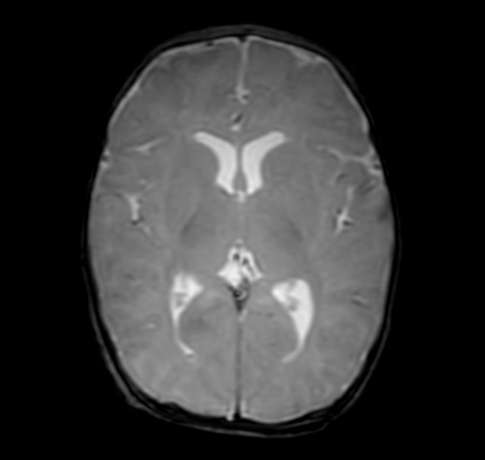 Axial T2w FFE with ComforTone