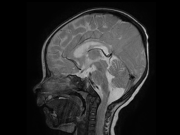 Sagittal T2w TSE with ComforTone