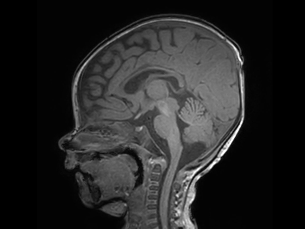 Sagittal 3D T1w TFE with ComforTone