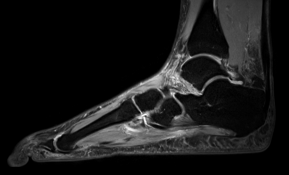 Sagittal PDw TSE mDIXON XD (Water only)