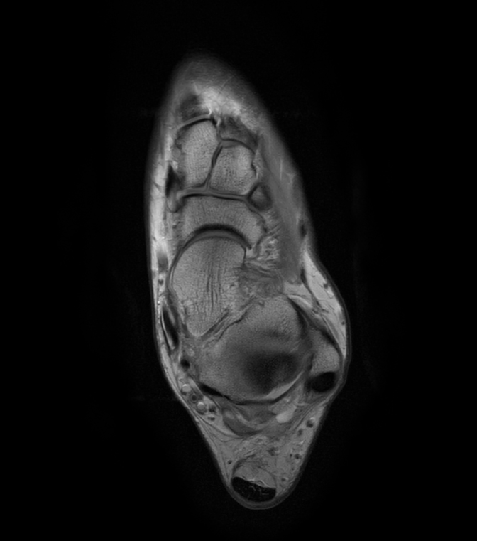Axial Dual TSE - PDw 