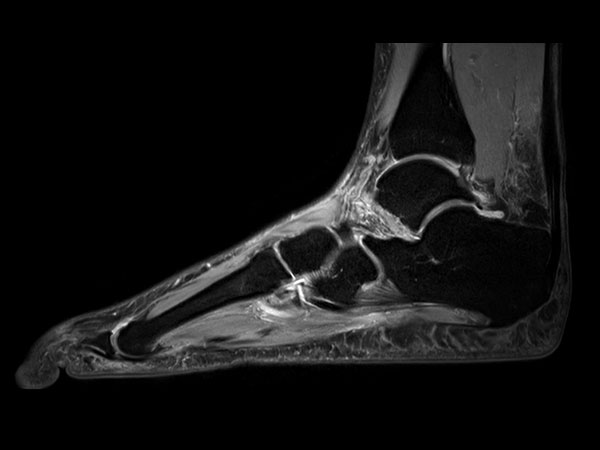 Sagittal PDw TSE mDIXON XD (Water only)