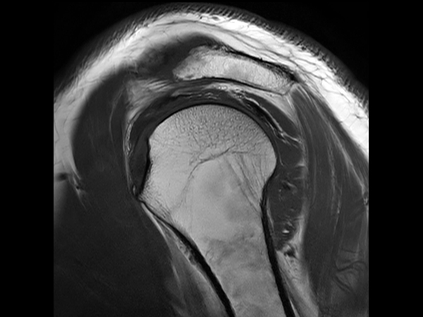 Sagittal T1w TSE with Compressed SENSE