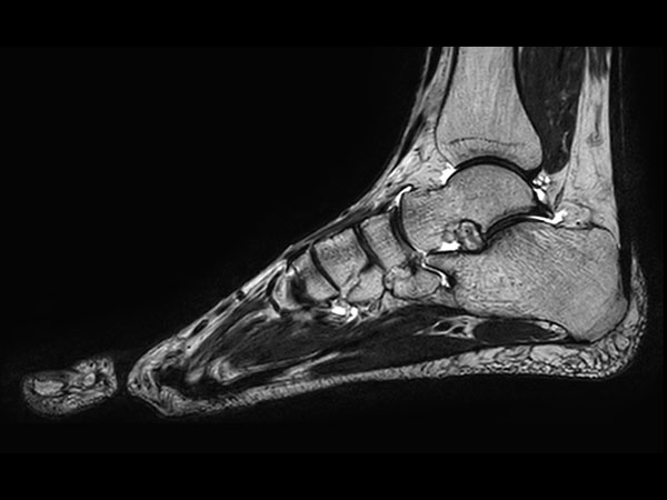 Sagittal 3D VIEW T2w TSE