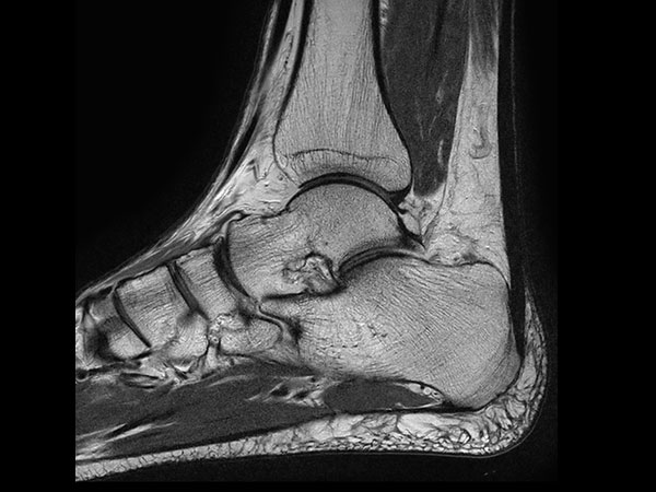 Sagittal T2w TSE