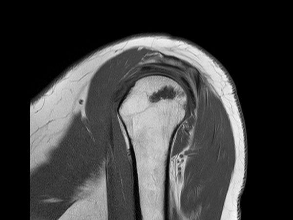 Sagittal T1w TSE