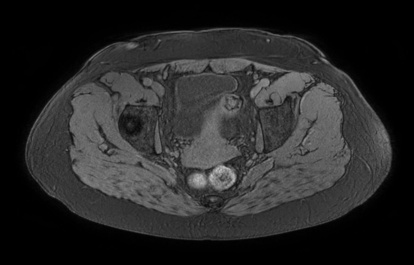 Axial eTHRIVE (high resolution)