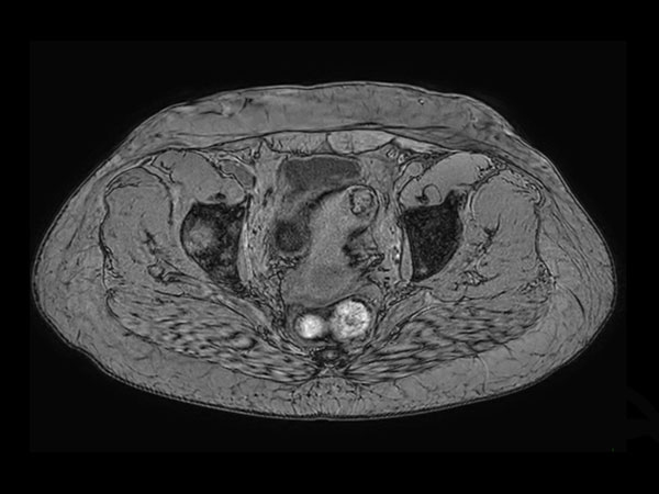 Axial eTHRIVE