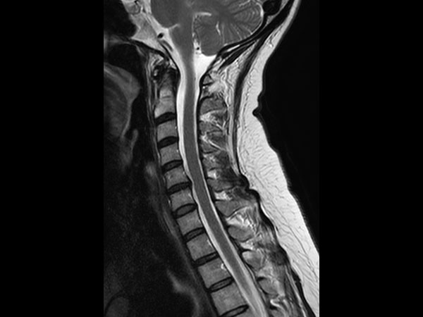 Sagittal T2w TSE